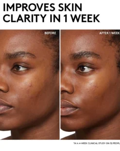 Cherry Dub BHA Toner with Salicylic Acid + Aloe Juice