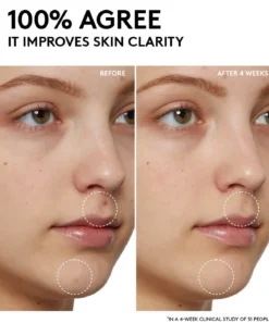 Cherry Dub Pore Purify'r Gel Cleanser with Niacinamide + Aloe Juice